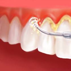 Aster Dental clinic