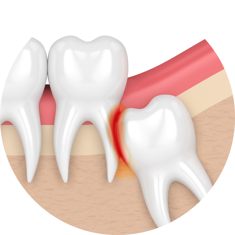 Aster Dental clinic